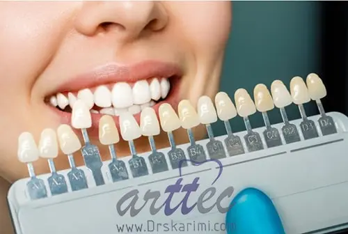 How to have straight teeth